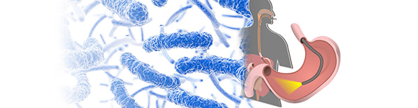 Endoscope/ Duodenoscope Superbug Infection Lawsuits