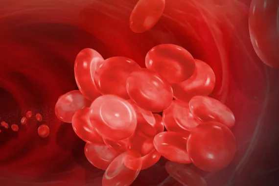 A drawing of blood cells in an artery. Cells in the background are in a row. The foreground cells are clumped to depict a blood clot