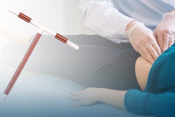 A doctor wearing gloves is examining a woman’s abdomen. The patient is lying down. On the left is a picture of an intrauterine device