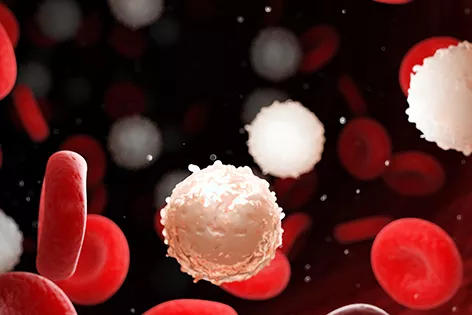 An illustration of red and white blood cells. The cells look like disks. The red cells appear normal, but the white cells appear damaged