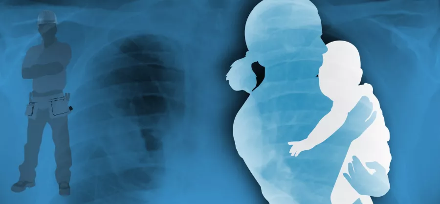 The Changing Face of Asbestos‑Related Diseases